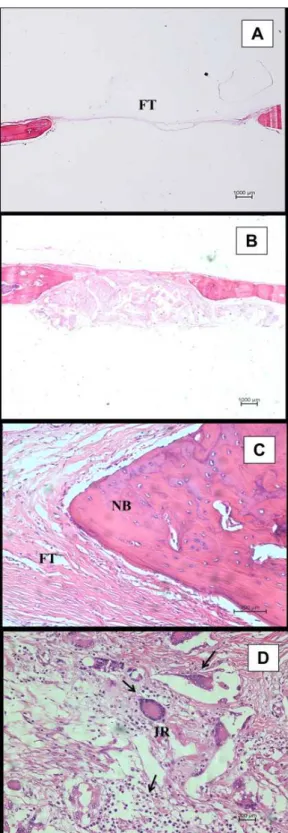 Figure 5D  shows that a severe inlammatory response  involving the iniltration of leukocytes, macrophages and  giant cells was observed with all PLDLA implants