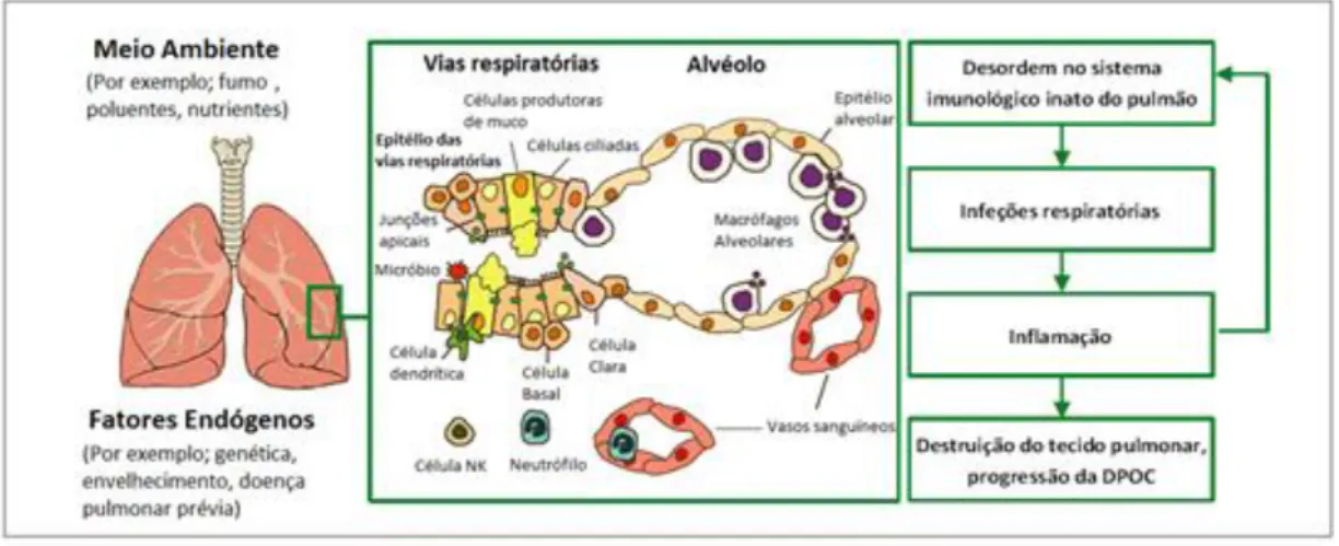 Figura 2 - Papel do  sistema  imunológico inato na patogénese da DPOC. Vários fatores ambientais e  endógenos  determinam  o  estado  do  sistema  imunológico  inato  do  pulmão,  a  qual  inclui  a  barreira  epitelial das vias respiratórias compostas por