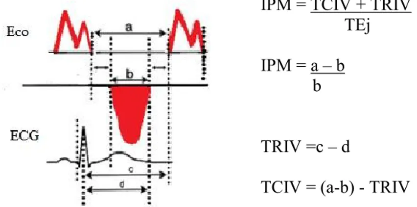 Figura 1- Diagrama para cálculo do índice de performance miocárdica  IPM = TCIV + TRIV 