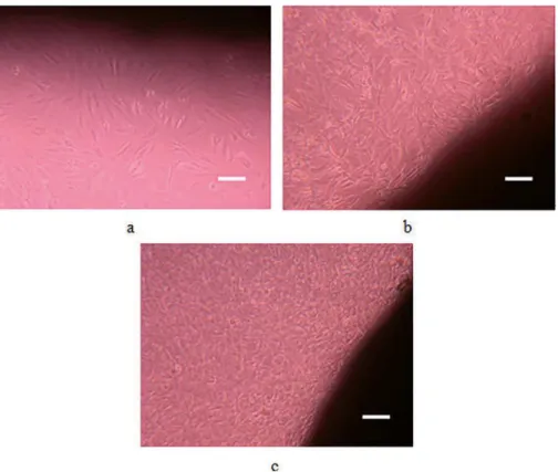 Figure 4: Optical micrographs of cells after 1 d (a), 7 d (b) and 14 d (c) of culturing with the inhomogeneous  scafolds (scale bar 20 μm)