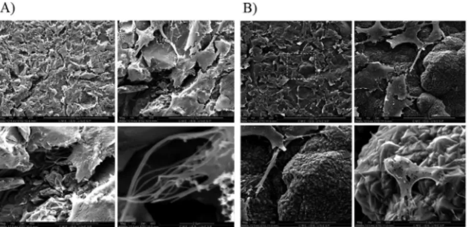 Figure 9. Scanning electron microscopy of osteoblast cells on rough titanium without (left) or with  (right) the diamond ilm.