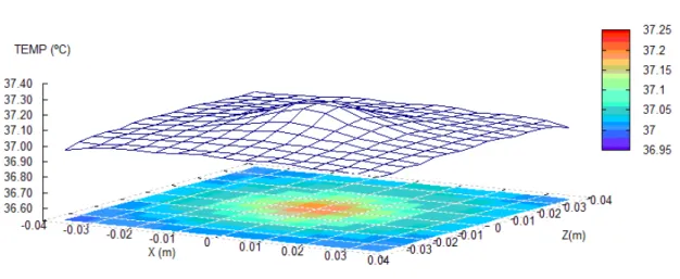 Figure 5   Temperature distribution for the spherical model . 