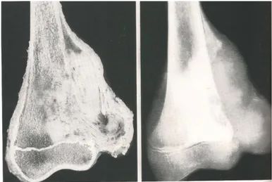 Figura 2. Fotografia e radiografia de paciente com osteossarcoma.  
