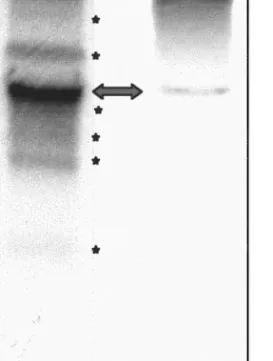 FIG. 2. Northern blot analysis of HdV RNAs. HdV-specific RNAs were detected with 32 P-labeled BamHI–HindIII-digested genomic viral DNA in total RNA extracted from Sf9 cells 44 h postinfection (lane 1 [Sf]) and in S