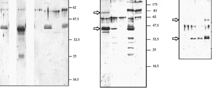 FIG. 5. Northern blot analysis of HdV RNAs related to the M-group cDNAs. (A) Time course of M24 transcription