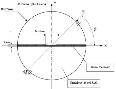 Table 1: The elastic constants of bone cement and stainless steel. 