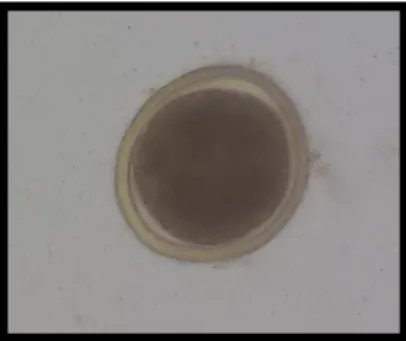 Figure  2.  Toxocara  cati  egg  showing  the  thick  external  layer,  internal  wall  and  unicellular  embryo (aprox