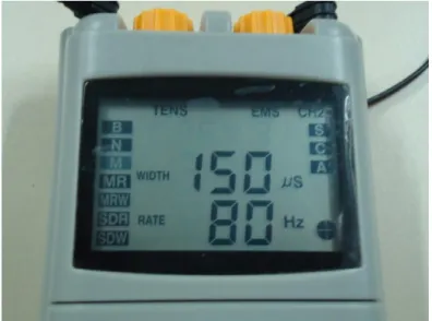 Figura 9 – Equipamento de eletroestimulação nervosa transcutânea. 