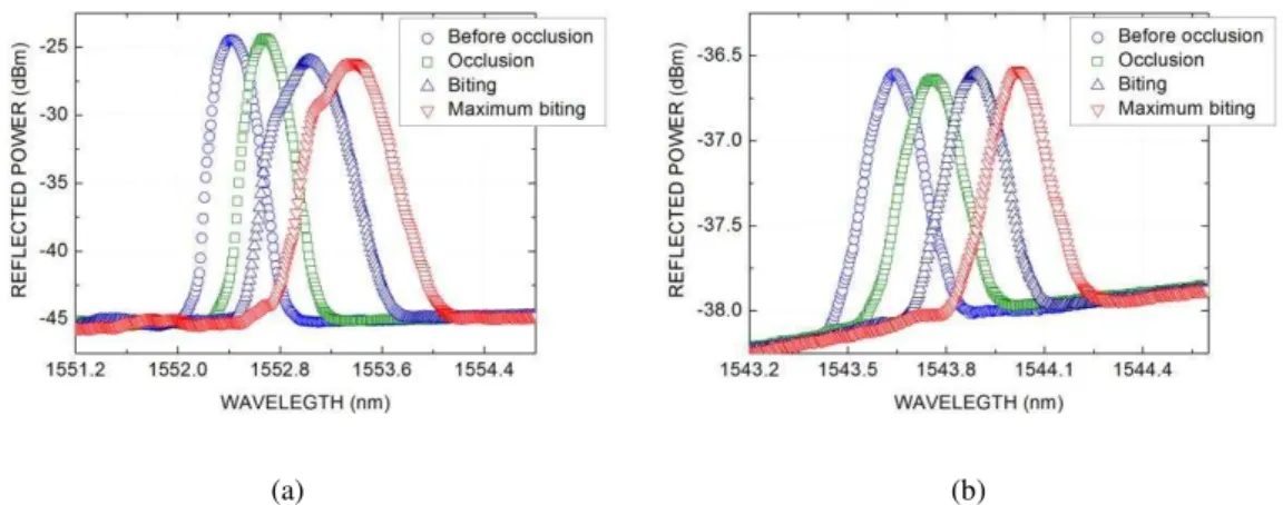 Fig. 7. In vivo evaluation: FBG optical reflection spectra for sensor at first right molar of (a) female and (b) male volunteers,  at different stages (before occlusion, occlusion and biting)