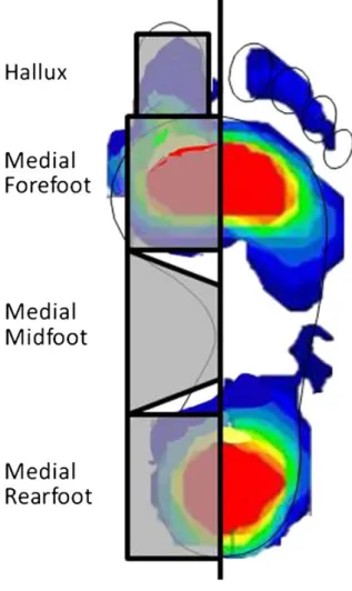 Figure 3 – In Relationships between clinical measures of static foot posture and plantar pressure during  static standing and walking