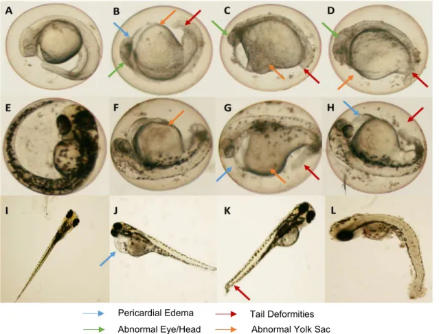 Figure 8 Zebraﬁsh embryos abnormalities during exposure to CTAB-AuNRs. At 24 hpf: Control embryos  (A) and embryos exposed to 104 µg/L (B), 125 µg/L (C) and 150 µg/L (D)