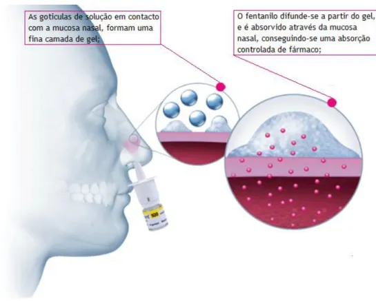 Figura 7 - Administração IN de PecFent®. Quando da sua administração no interior da cavidade nasal, a  solução em contacto com o muco nasal forma uma fina camada de gel