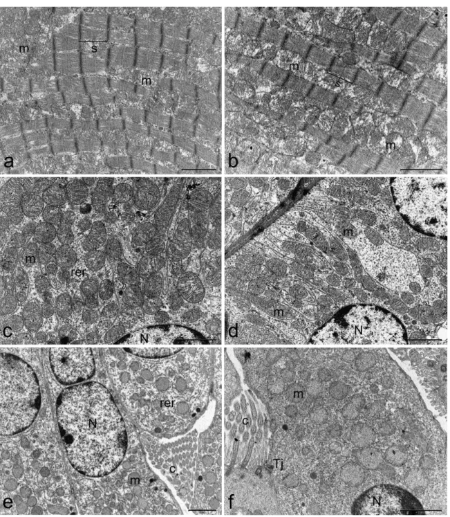 Figure 4. Representative electron micrograph showing ultrastructure of heart (a,b), kidney (c,d), and  lung (e,f) of control mice (first column) or mice treated with 500 µ g/kg bw TTX (second column)