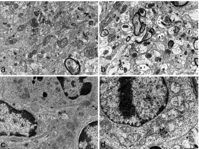 Figure 5. Representative electron micrograph showing ultrastructure of brain (a,b) and spleen (c,d)  of  control  mice  (first  column)  or  mice  treated  with  500  µ g/kg  bw  TTX  (second  column)