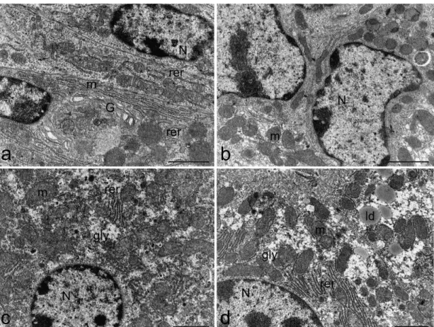 Figure 6. Representative electron micrograph showing ultrastructure of stomach (a,b) and liver (c,d)  from control mice (a,c) and mice treated with 500 µ g/kg bw TTX (b,d)