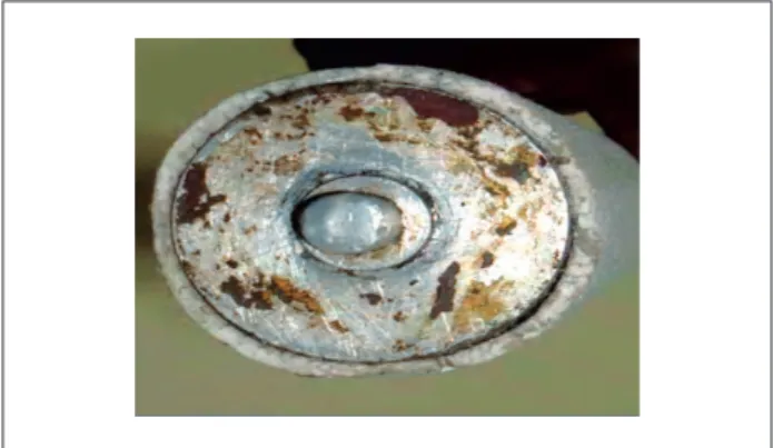 Figure 6. Casting mould with collapsible mandrel after casting.