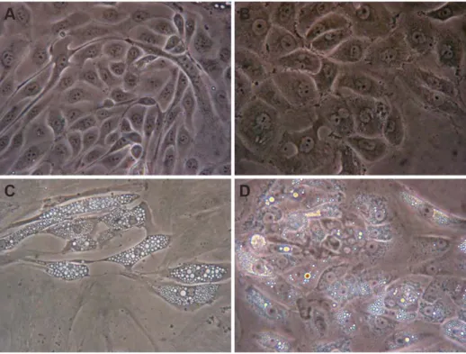 Figure 3. Representative morphology of confluent monolayers. (A) Primary HPTEC, (B) HK-2 cell line, (C) primary clear cell RCC, and (D) primary chromophobe RCC