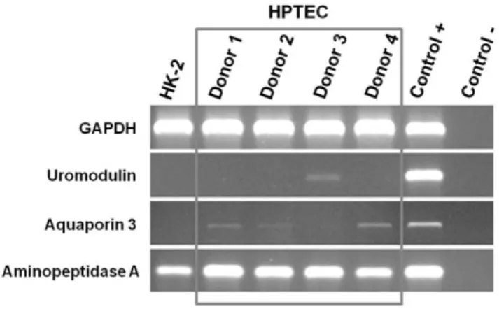 Figure 5. RT-PCR analysis. Uromodulin (distal tubule marker), aquaporin 3 (collecting duct marker), and aminopeptidase A (proximal tubule marker) in primary cultured HPTEC derived from 4 donors and HK-2 cells
