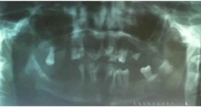 Fig. 2 – Ortopantomografia. 