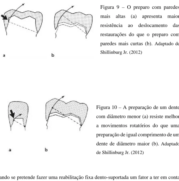 Figura 9 –  O preparo com paredes  mais altas (a) apresenta maior  resistência ao deslocamento das  restaurações do que o preparo com  paredes mais curtas (b)
