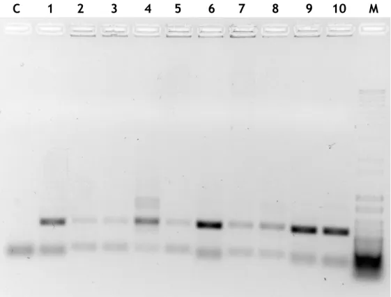 Figure 12 - PCR-colony products in an agarose gel electrophoresis (1,5%) of colonies 11 to 20