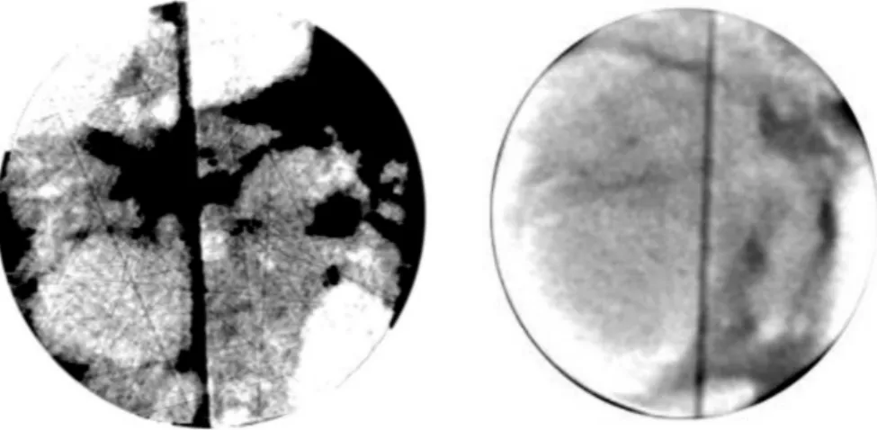 Figure 8: CT images. The darkest areas are the possible water leaching path.