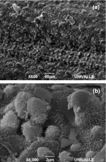 Figure 4: SEM wide view (X600) (a) and detailed view (X6000)  (b) of RS.
