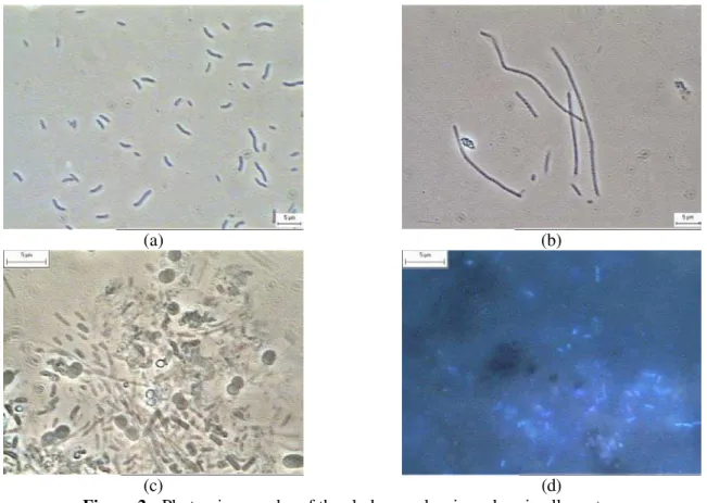 Figure 2:  Photomicrography of the sludge used as inoculum in all reactors   (a – rods; b – Methanosaeta-like; c – cocci; d – cocci and rod-like archaeal cells)