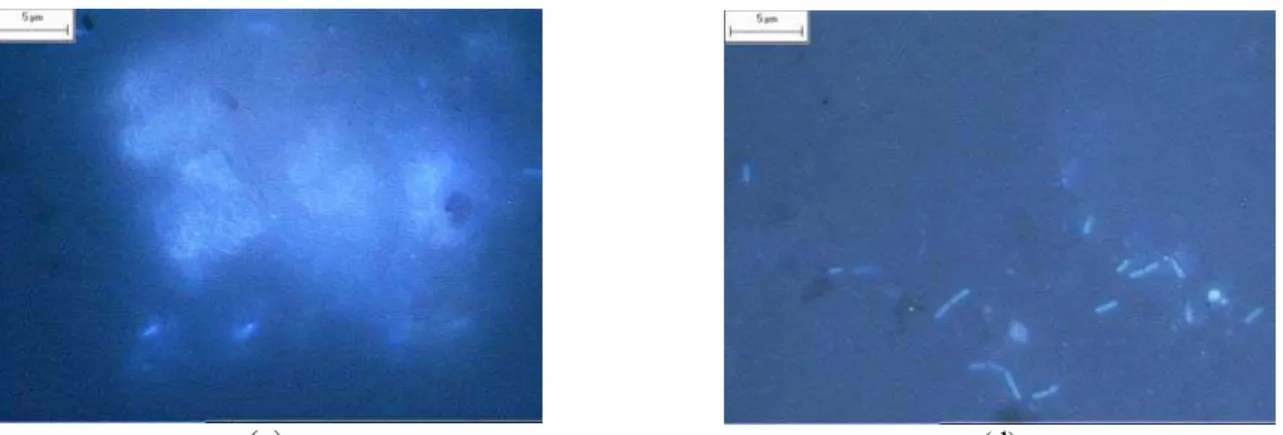 Figure 3: Photomicrography of the sludge used in ASBR reactor  (a – rods; b – filaments;  