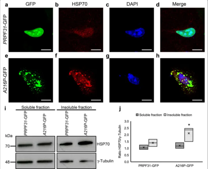 Fig. 7 Overexpression of A216P-GFP induces HSP70 activation in ARPE-19 cells. Immunostaining of cultured ARPE-19 cells transfected with PRPF31 -GFP (a-d) or A216P -GFP (e-h) displays PRPF31 aggregation in the cytoplasm of the cells overexpressing A216P -GF