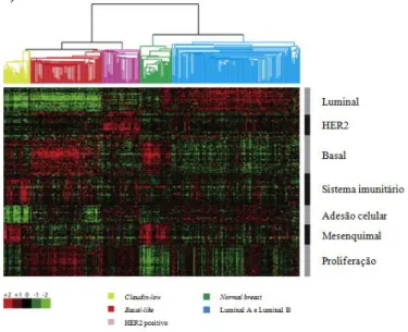 Figura  11  –  Análise  de  agrupamento  hierárquico  de  dados  de  padrões  de  expressão genética obtidos através de microarrays de ADNc (adaptado de Prat 