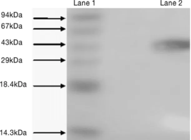 Figure 1: Electrophoretogram of protein after various steps of purification on  SDSPAGE