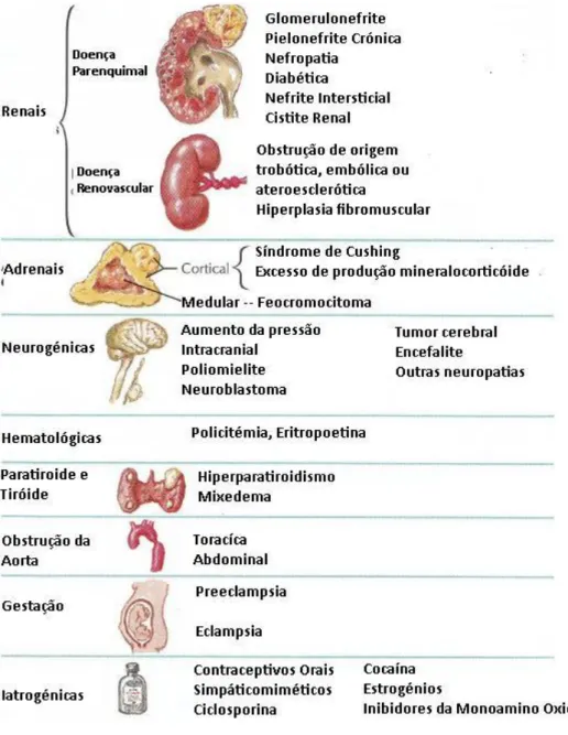 Figura 2.1 : Perturbações e outras causas para a hipertensão secundária. 