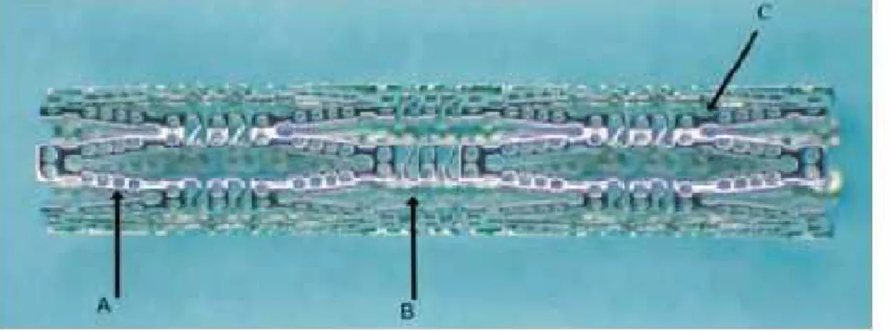 Figure 2: Laser drilled Conor stent with drug reservoirs, A-Drug/Polymer wells, B-sinusoidal  struts, C-ductile hinges 