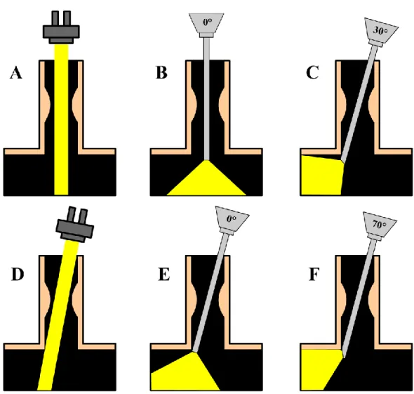Figura  1.  Desenho  esquemático  da  exposição  com  microscópio  (A  e  D) e  diversos  tipos  de  endoscópio  (B,  C,  E  e  F)