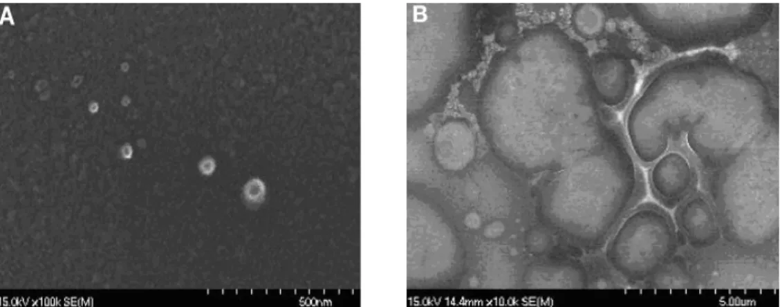 Figure 2: Scanning electron micrographs of (A) nanoparticles made by the ionic gelatation  method and (B) nanoparticles made by the reverse micelle method