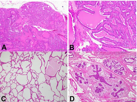 Figure 2. Dysplastic lesions and benign mammary tumors (Hematoxylin &amp; Eosin [HE])