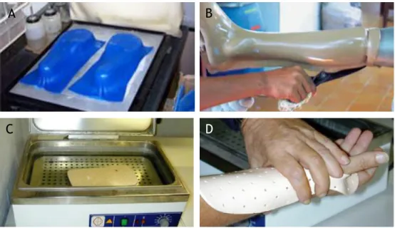 Figure 2.11 – Traditional processes for fabrication of orthoses. A: vacuum press for foot orthoses [60]