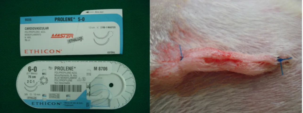 FIGURA  7  –  FIOS  DE  POLIPROPILENO,  5-0  E  6-0,  UTILIZADOS  NO  FECHAMENTO  DA  PAREDE  E  DA  ANASTOMOSE  (A)  E  COMPLETADA A SUTURA EM BARRA GREGA DA PELE (B)