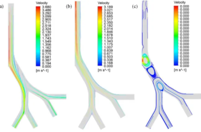 Figure 10: Streamlines after 1 second of inhalation  (a) and after 0.5 of exhalation (b) and breath holding  (c)