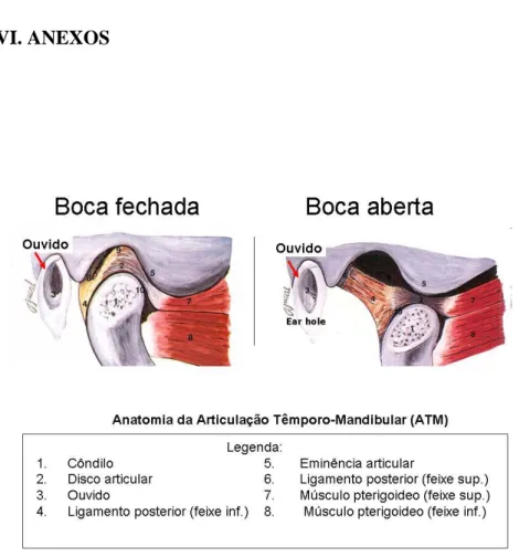 Figura  1-  ATM  com  boca  fechada  e  boca  aberta.  Fonte:  Fisiologia  e  mecanismos  biomecânicos  da  articulação  temporomandibular  ATM