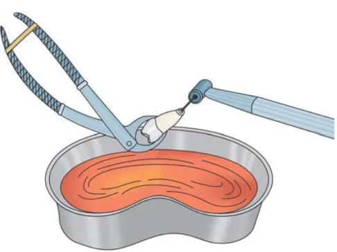 Figura III - Qualquer reparação ou procedimento deve ser feito tão rapidamente  quanto possível no banho de solução salina normal ou HBSS solução para evitar  a dessecação