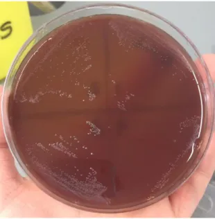 Figura 8 – Aspeto de quatro sementeiras de  Campylobacter spp. ou  Helicobacter pullorum  suspeitas,  após  repicagem  a  partir  da  caixa  inicial  e  44  ±  4  horas  em  estufa  a  41,5  ±  1°C  (imagem original) 
