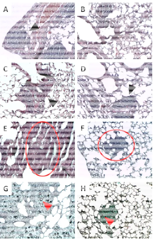 Figura  6. Fotomicrografia  dos  pulmões  de  animais  infectados  com  anfotericina B deoxicolato de sódio na forma livre (D