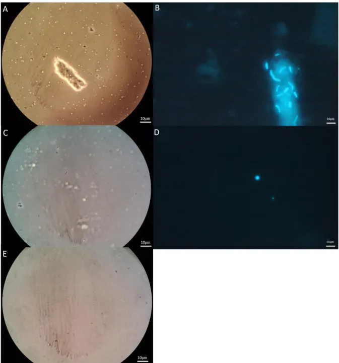 Figure 4.2: Phase contrast picture (A, C and E) and fluorescence microscope  pictures using Exitation350/Emission460 (B and D