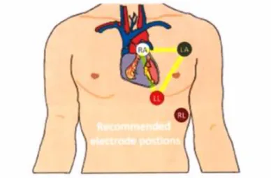 Figure 1: ECG electrodes placement. 