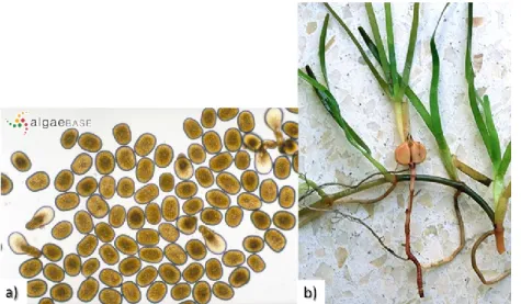 Figure  1.8  Spores  from  brown  macroalgae  Haplospora  globosa  (a)  (Source: 