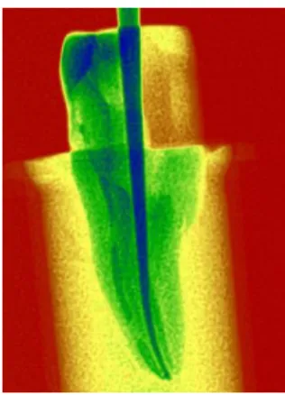 Figura 6 – Radiografia de confirmação do correto encaixe da amostra na mufla de silicona