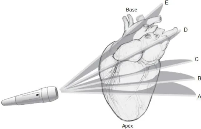 Figura  4.  Esquema  com  cinco  vistas  transversais  padrão,  a  partir  da  janela  paraesternal  direita, mostrando os ajustes necessários a fazer ao posicionamento da sonda (Adaptado de  Boon, 2011)