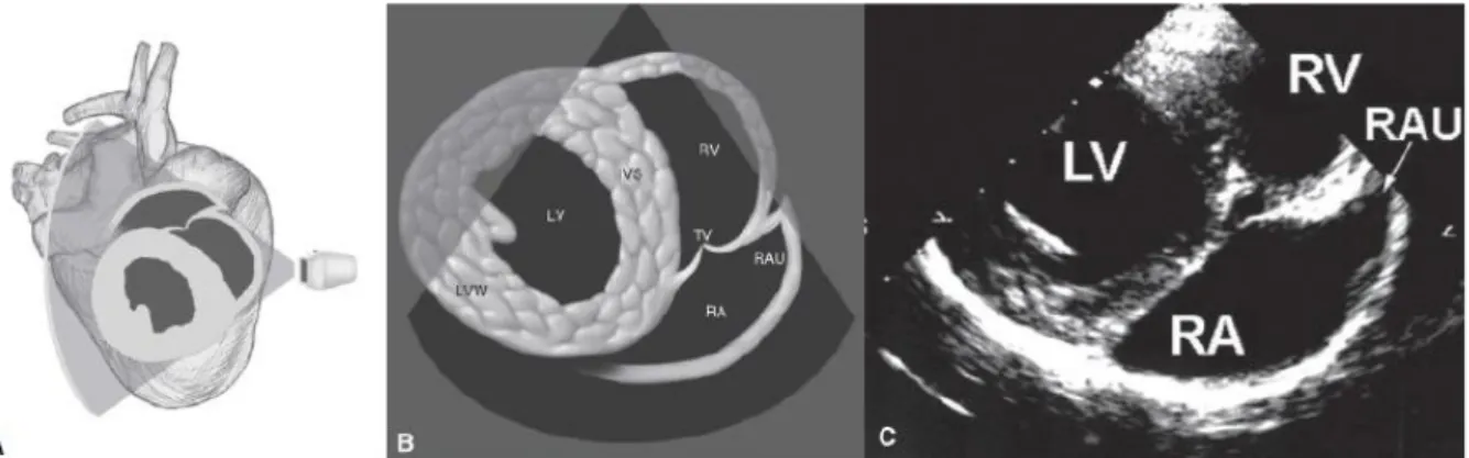 Figura 12. Esquema (A e B) e imagem ecocardiográfica em modo B (C) do corte longitudinal  com do átrio e ventrículo direitos, a partir da janela paraesternal esquerda cranial (Adaptado  de Boon, 2011)